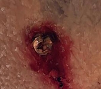 Bewertungsbild zu der Überschrift Funktioniert super liegt im Knall